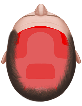 head