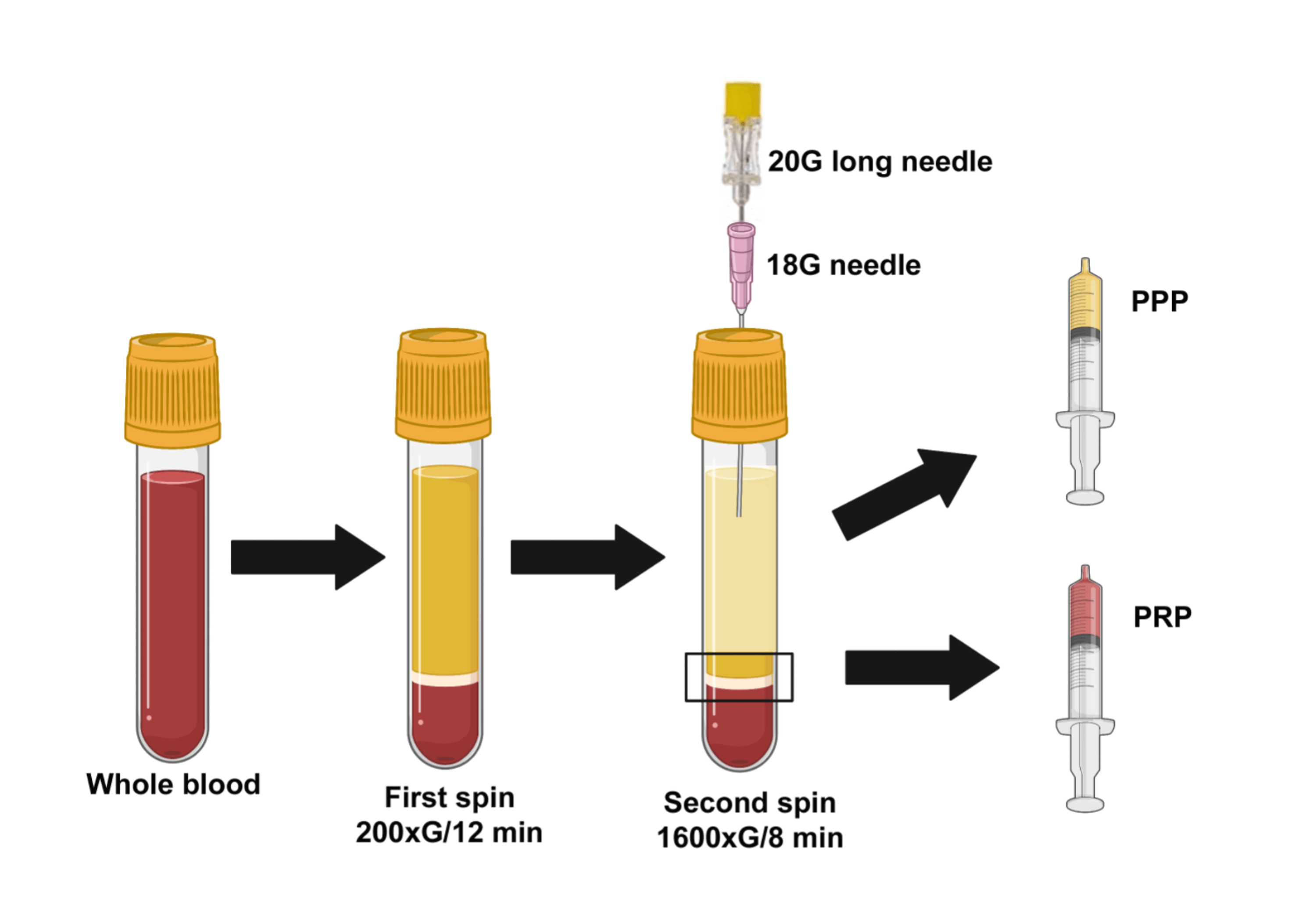 platelet rich plasma