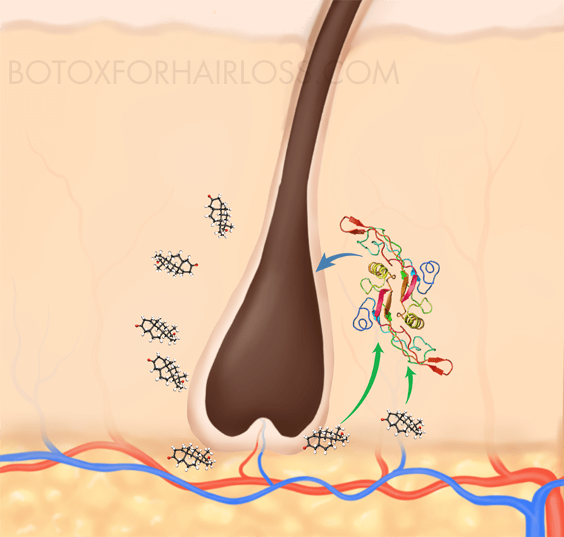 DHT causes the release of TGF- β1